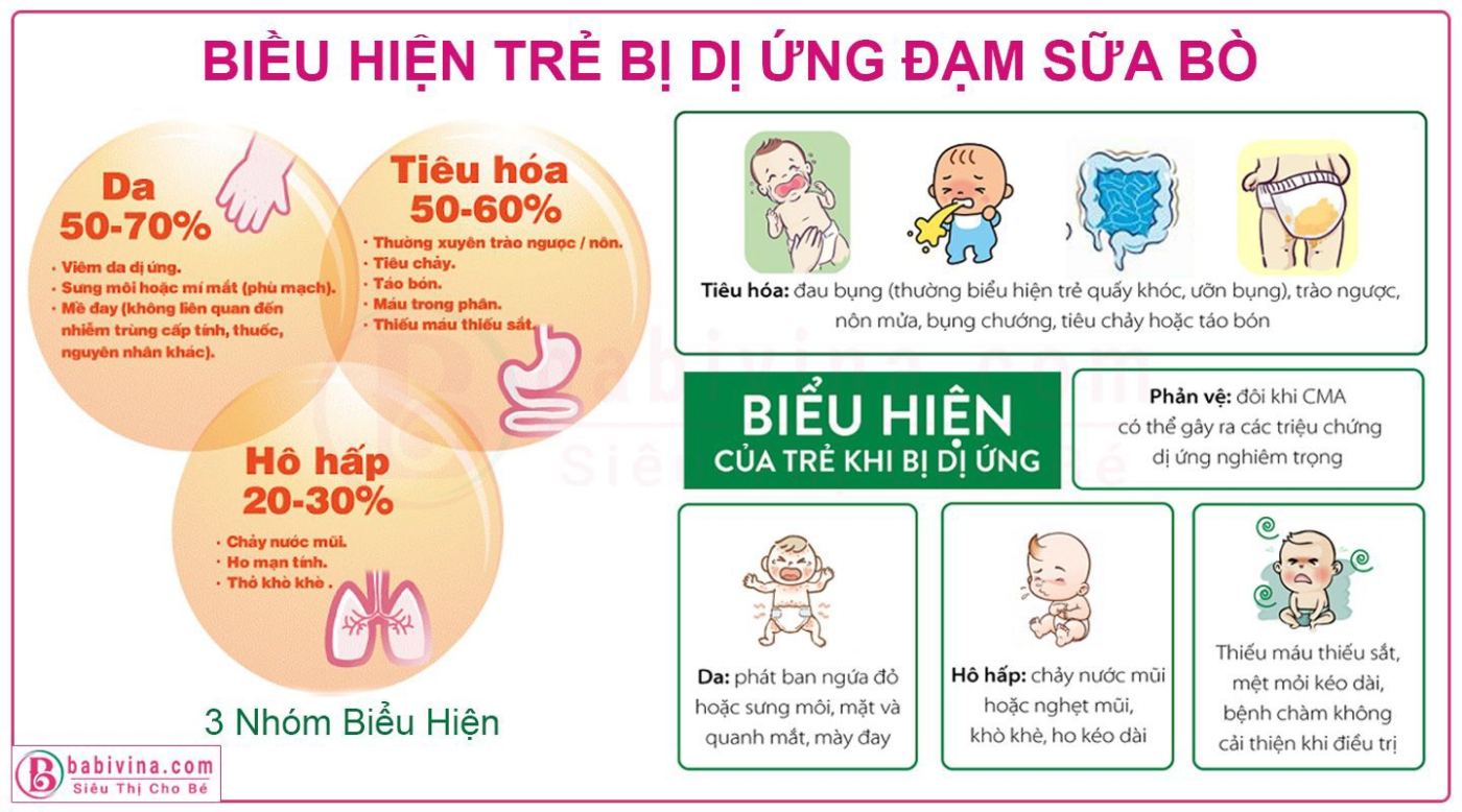 Giải pháp dinh dưỡng cho trẻ bị dị ứng đạm bò